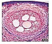 Follicule tertiaire